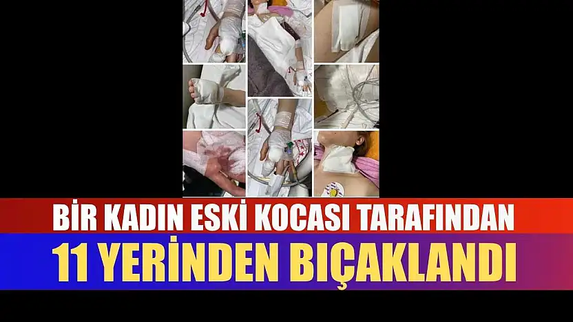 Bir kadın, eski kocası tarafından 11 yerinden bıçaklandı