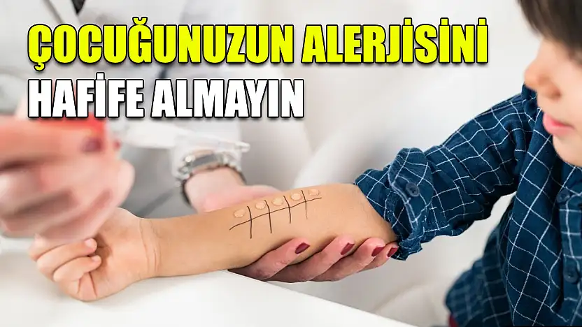 Çocuğunuzun alerjisini hafife almayın