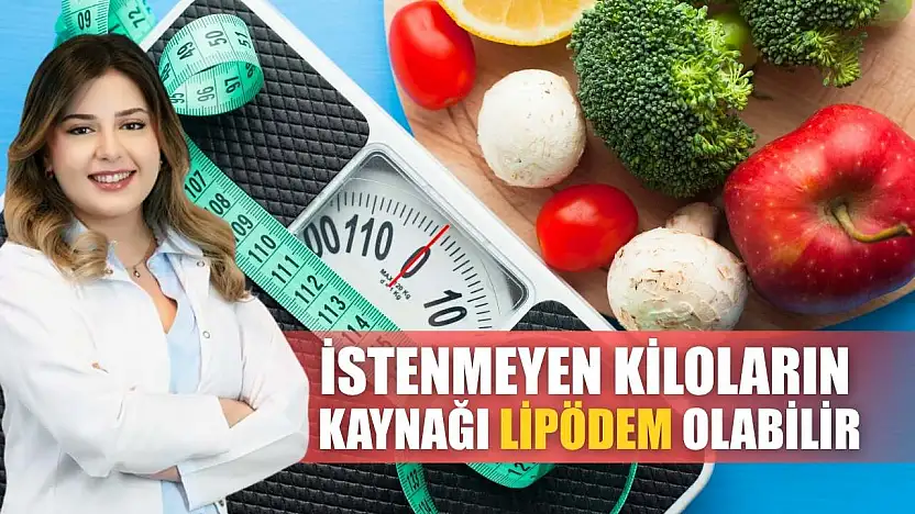 İstenmeyen kiloların kaynağı lipödem olabilir