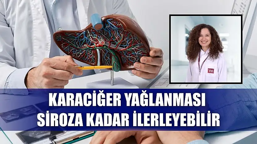 Karaciğer yağlanması siroza kadar ilerleyebilir