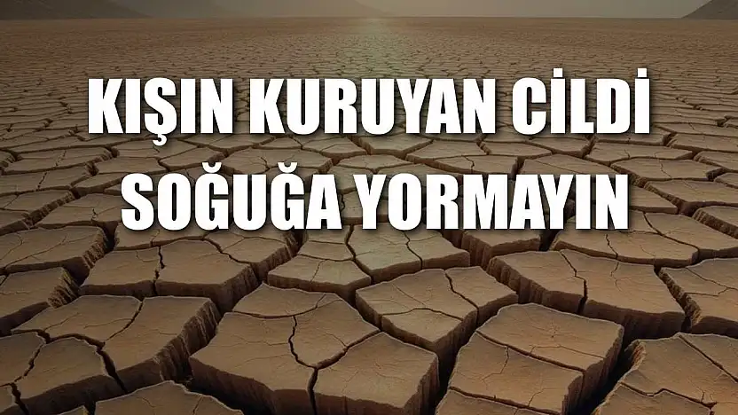 Kışın kuruyan cildi soğuğa yormayın