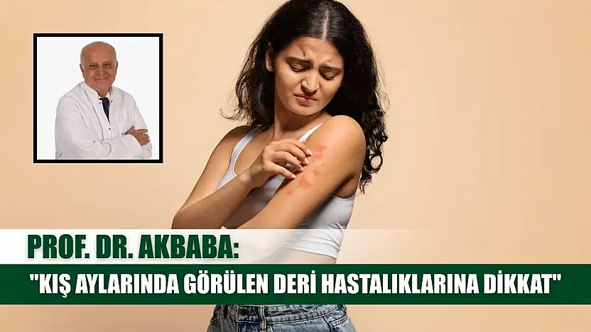 Prof. Dr. Akbaba: 'Kış aylarında görülen deri hastalıklarına dikkat'