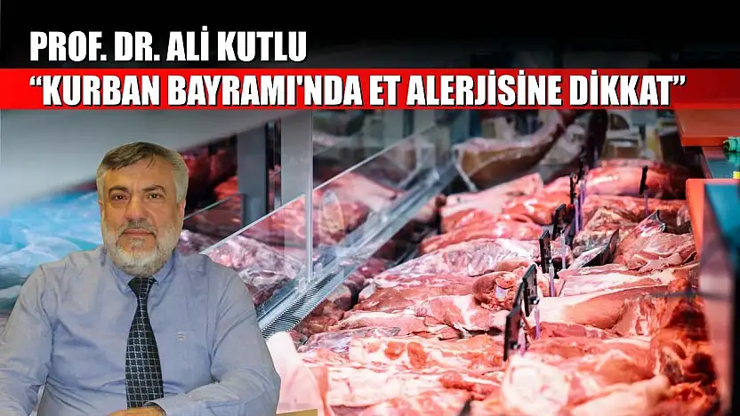 Prof. Dr. Ali Kutlu: 'Kurban Bayramı'nda et alerjisine dikkat'