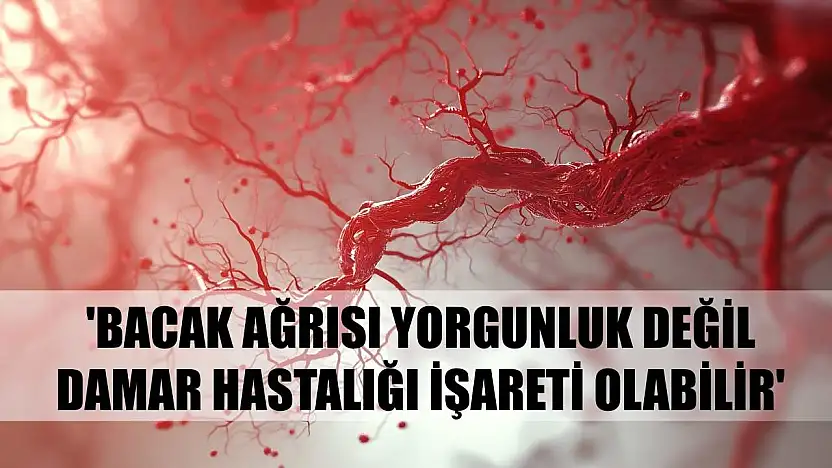 Uzmanı uyardı: 'Bacak ağrısı yorgunluk değil, damar hastalığı işareti olabilir'