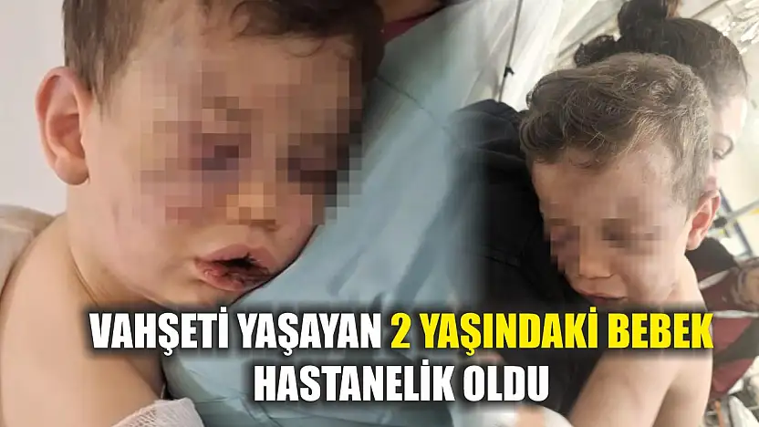 Vahşeti yaşayan 2 yaşındaki bebek hastanelik oldu