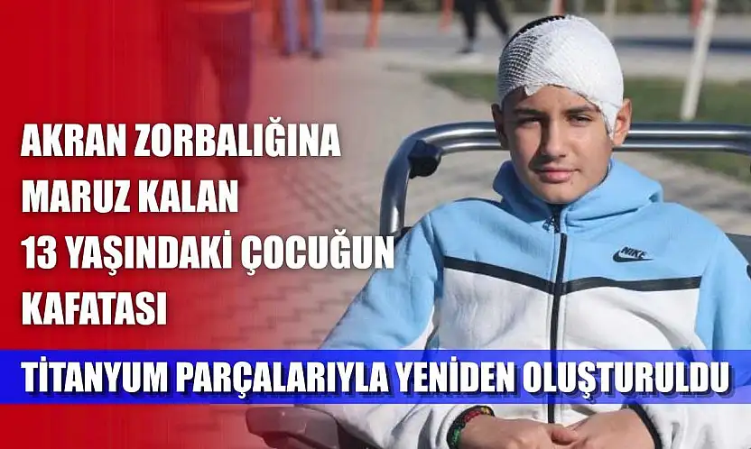 Akran zorbalığına maruz kalan 13 yaşındaki çocuğun kafatası titanyum parçalarıyla yeniden oluşturuldu