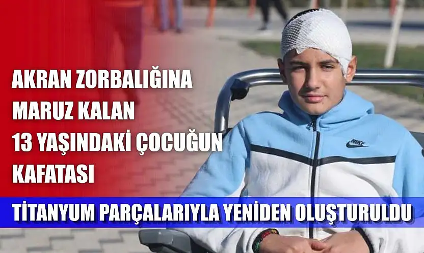 Akran zorbalığına maruz kalan 13 yaşındaki çocuğun kafatası titanyum parçalarıyla yeniden oluşturuldu