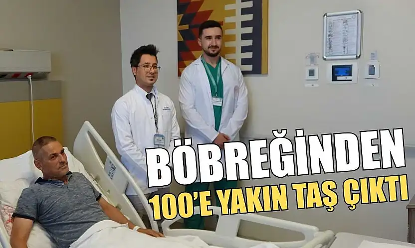 Böbreğinden 100'e yakın taş çıktı