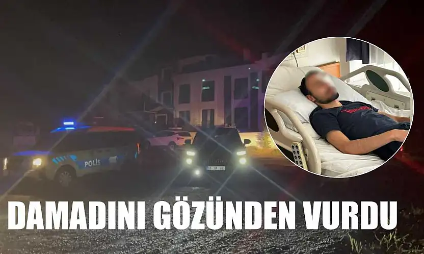 Damadını gözünden vurdu