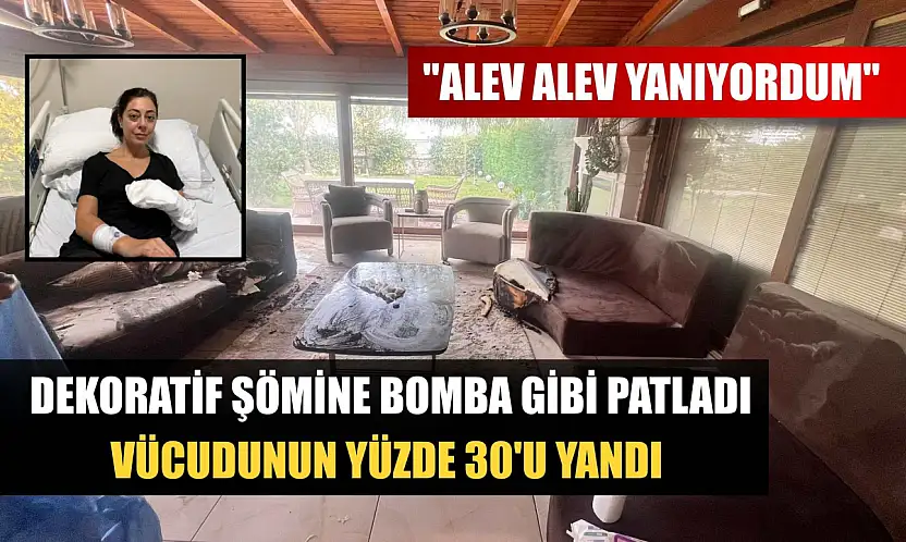 Dekoratif şömine bomba gibi patladı, vücudunun yüzde 30'u yandı: 'Alev alev yanıyordum'