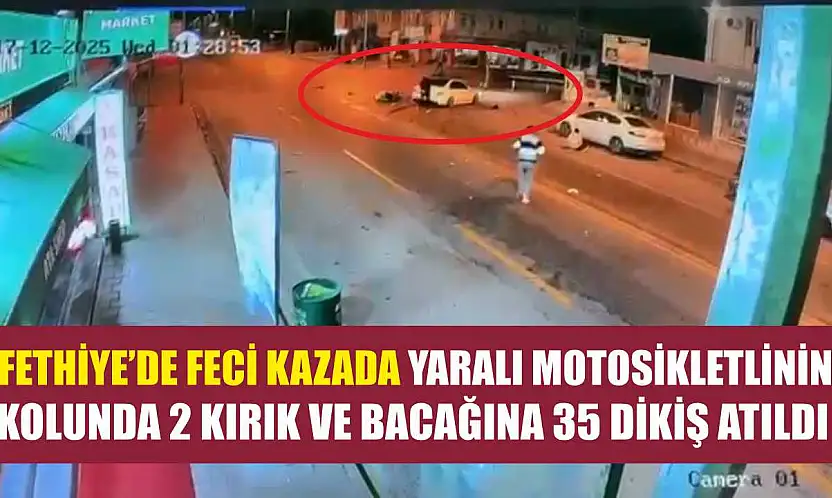 Fethiye'de feci kazada yaralı motosikletlinin kolunda 2 kırık ve bacağına 35 dikiş atıldı