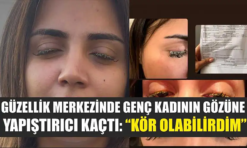 Güzellik merkezinde genç kadının gözüne yapıştırıcı kaçtı: 'Kör olabilirdim'