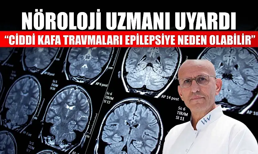 Nöroloji uzmanı uyardı: 'Ciddi kafa travmaları epilepsiye neden olabilir'