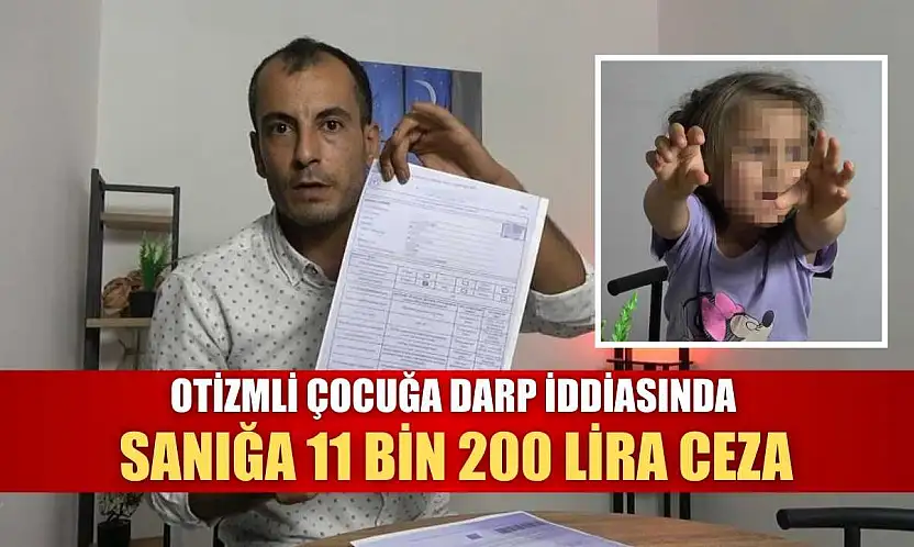 Otizmli çocuğa darp iddiasında sanığa 11 bin 200 lira ceza