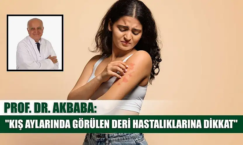 Prof. Dr. Akbaba: 'Kış aylarında görülen deri hastalıklarına dikkat'