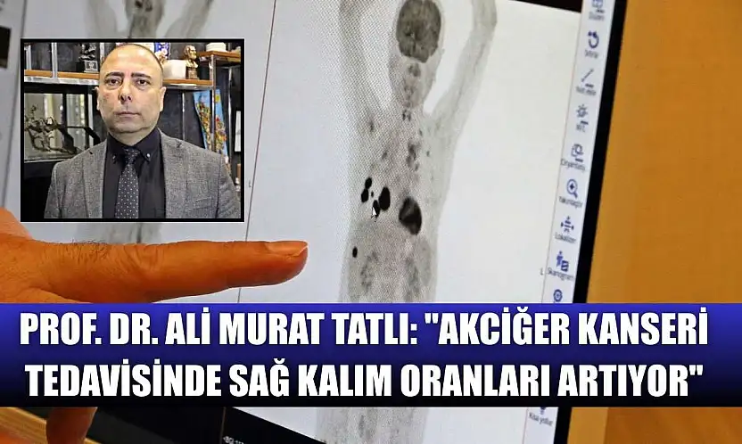 Prof. Dr. Ali Murat Tatlı: 'Akciğer kanseri tedavisinde sağ kalım oranları artıyor'