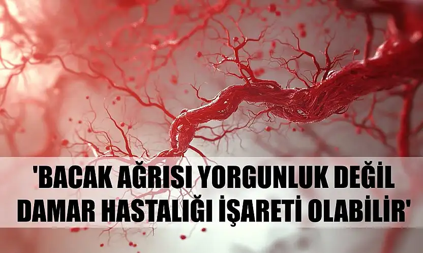 Uzmanı uyardı: 'Bacak ağrısı yorgunluk değil, damar hastalığı işareti olabilir'