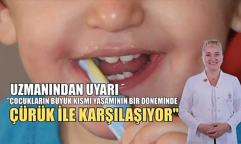 Uzmanından uyarı: 'Çocukların büyük kısmı yaşamının bir döneminde çürük ile karşılaşıyor'