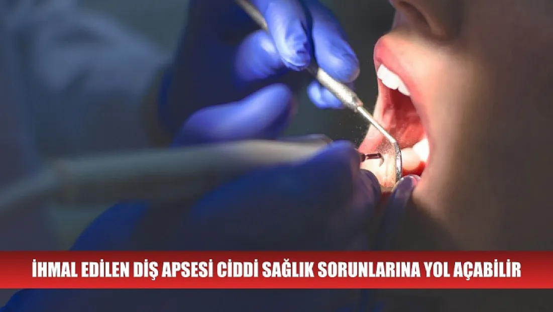 İhmal edilen diş apsesi ciddi sağlık sorunlarına yol açabilir