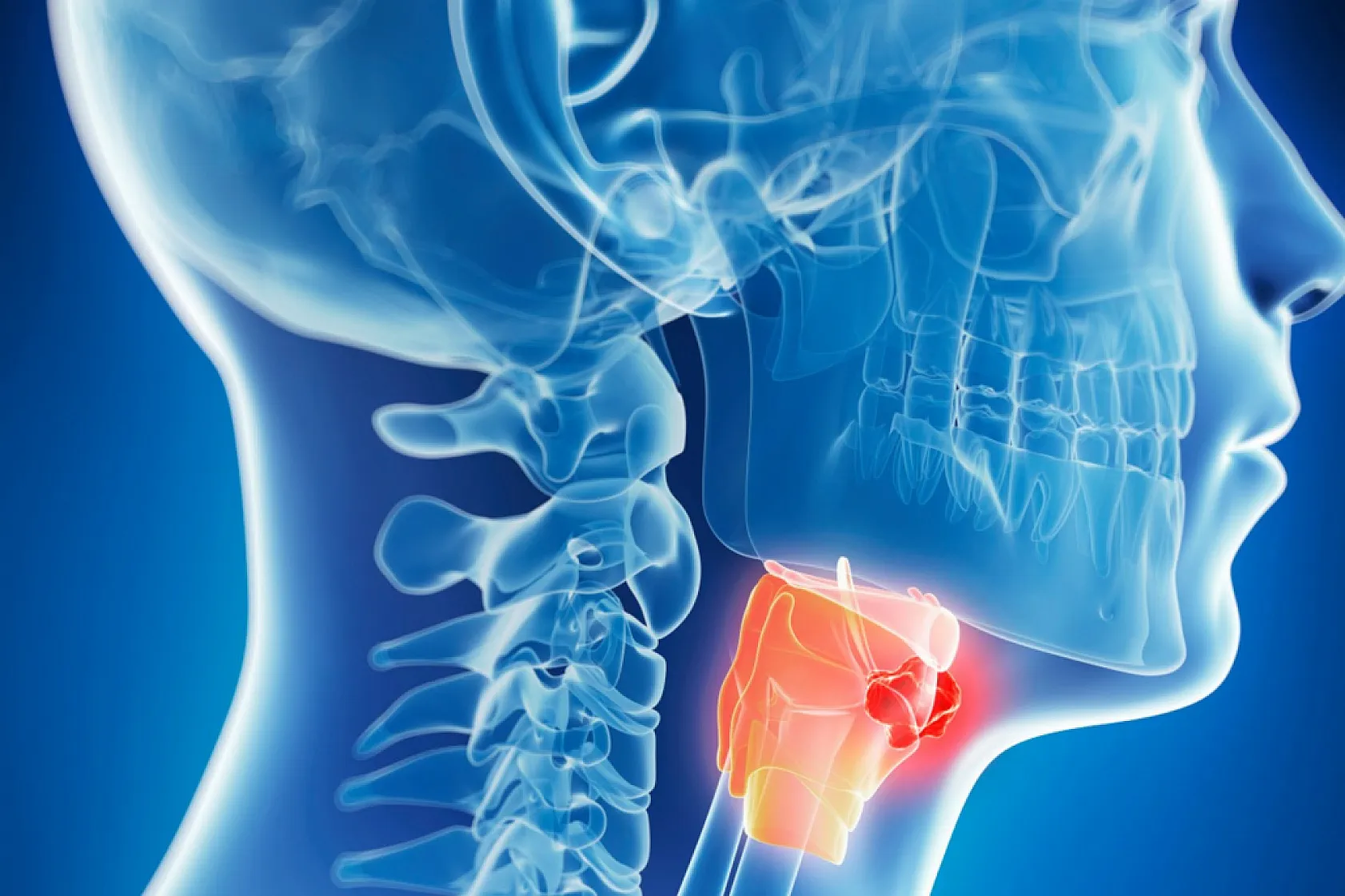 Baş Boyun Kanserlerinde Erken Teşhis Hayat Kurtarıyor