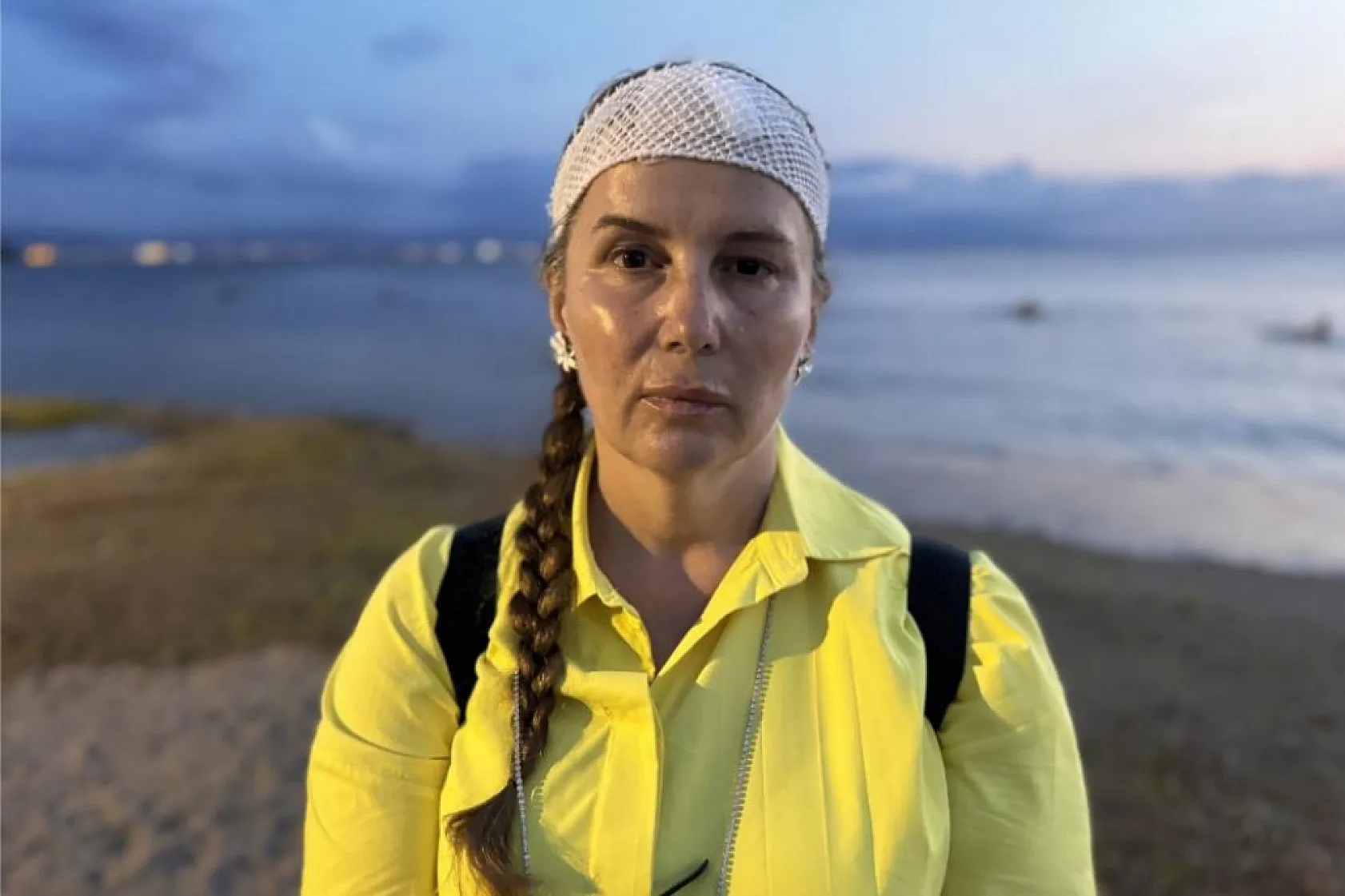 Denizde yüzerken jet ski çarptı, ölümden döndü