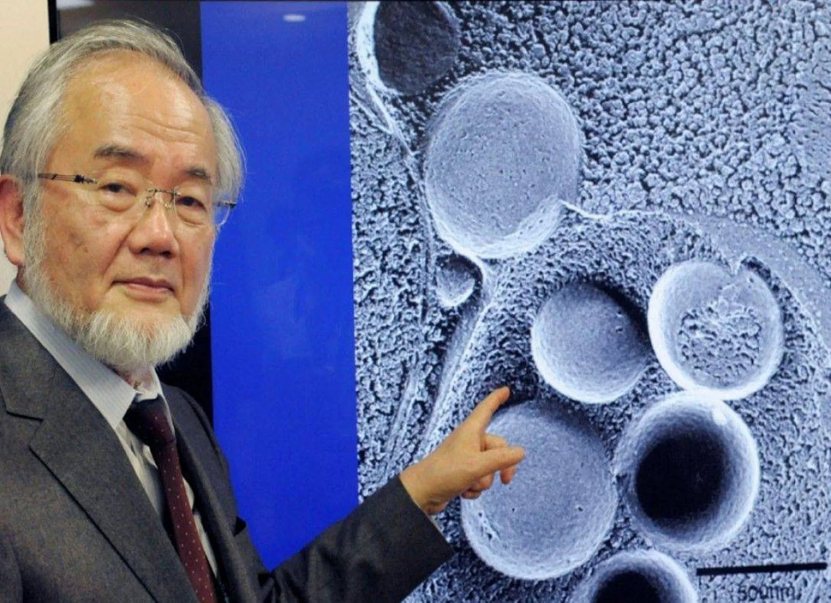 Japon bilim insanı kanıtladı, bakın oruç tutmak nelere yol açıyor? 