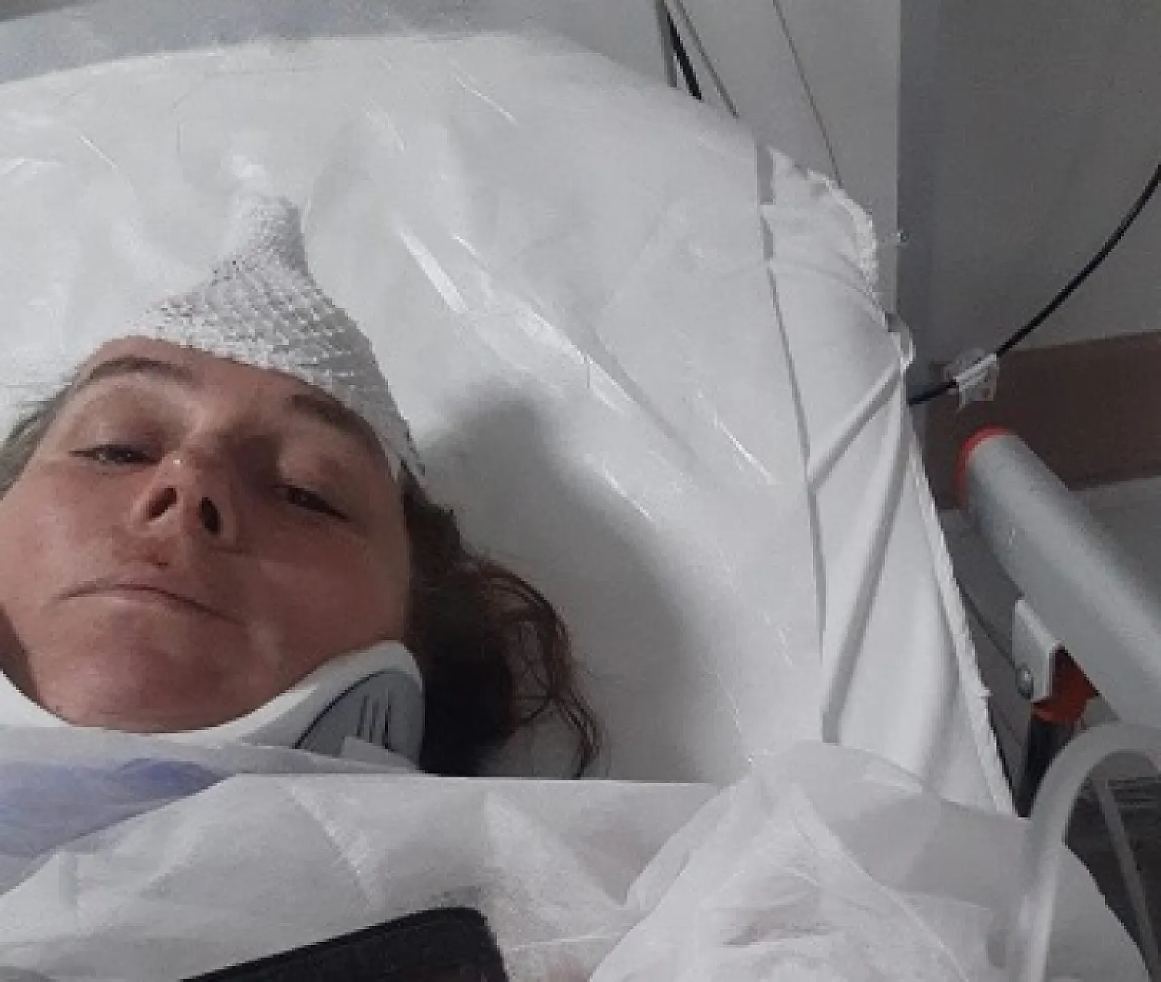 Denizde yüzerken jet ski çarptı, ölümden döndü