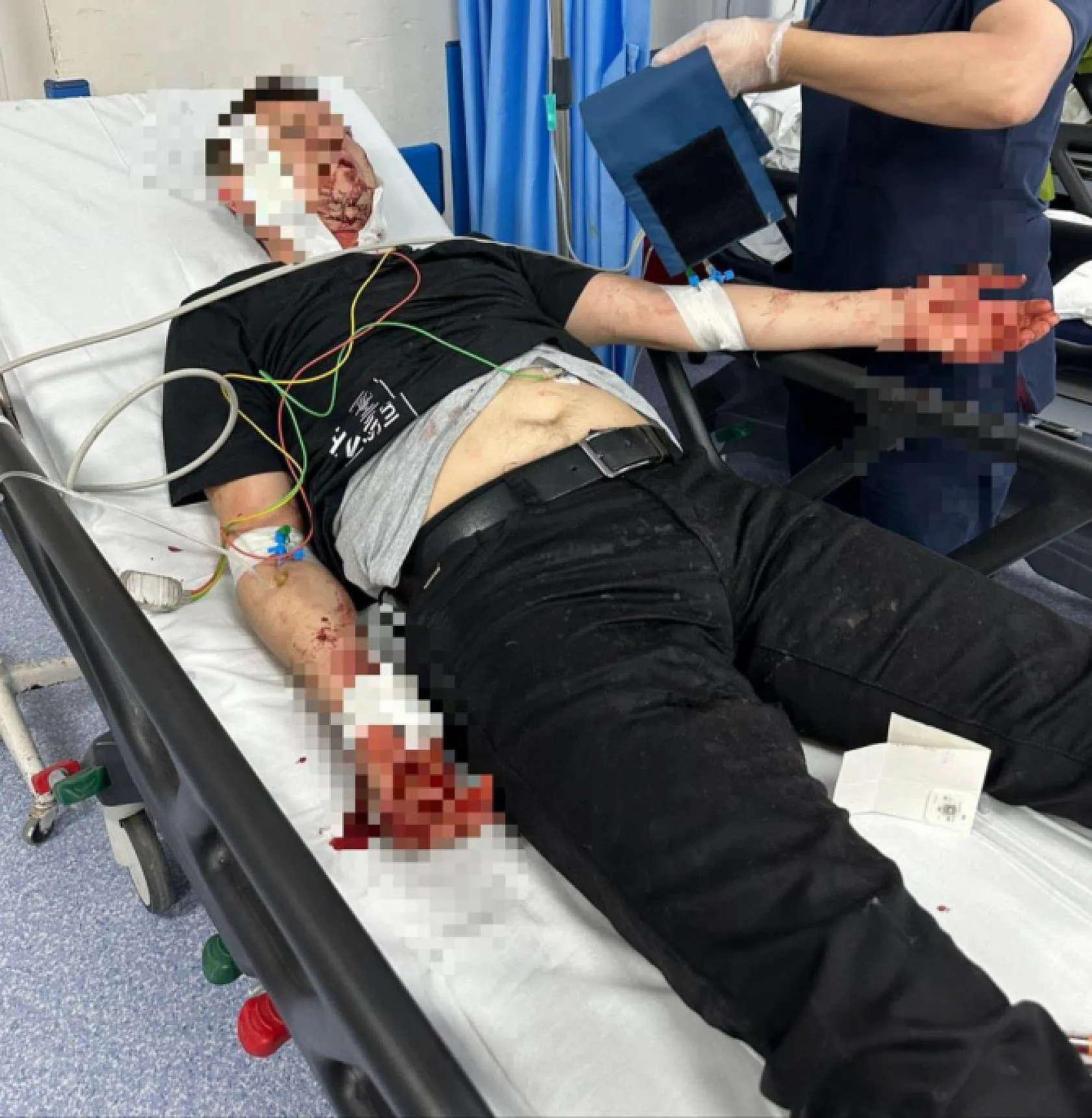 Başıboş köpek dehşeti! Oğlu için kendini feda etti ölümden döndü