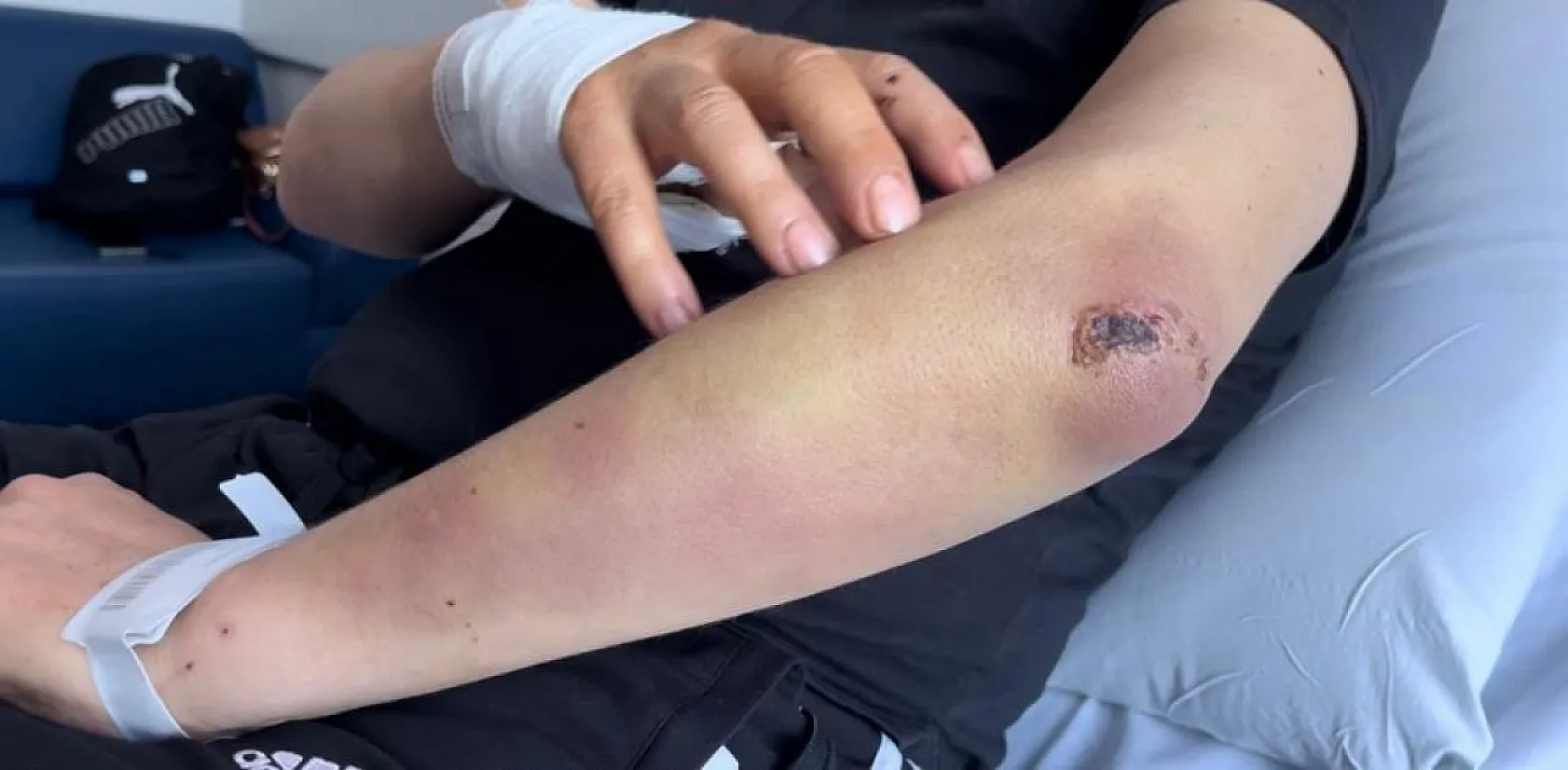 Başıboş köpek dehşeti! Oğlu için kendini feda etti ölümden döndü