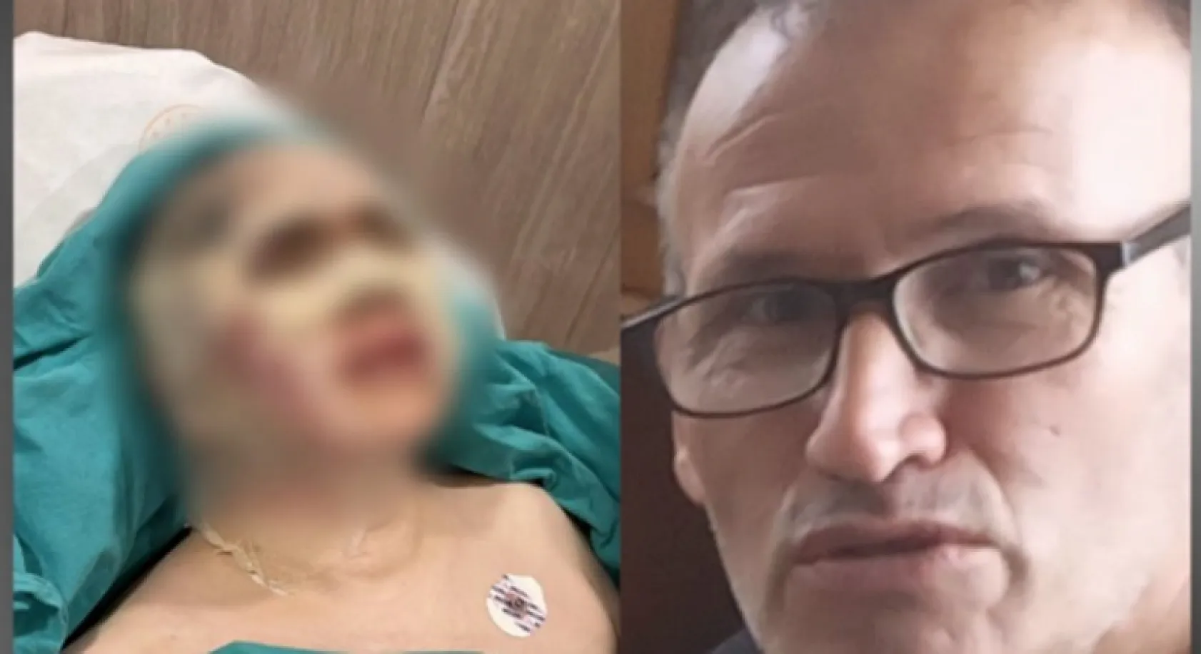 60 yaşındaki adam, reddedildiği kadının yüzüne kezzap attı