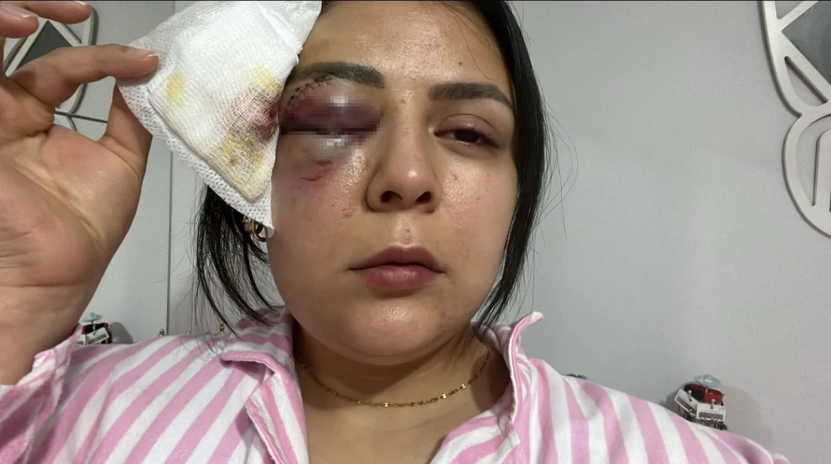 Yürürken saldırıya uğrayan genç kız konuştu: 'Psikolojim altüst oldu'