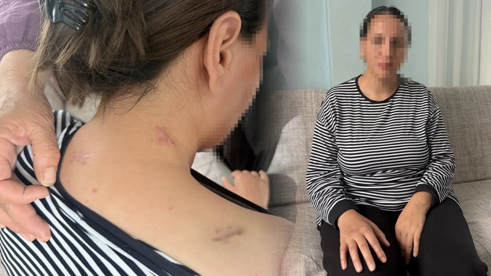 17 bıçak darbesi aldı, ölü numarasıyla kurtuldu, kocasının en ağır cezayı almasını istedi