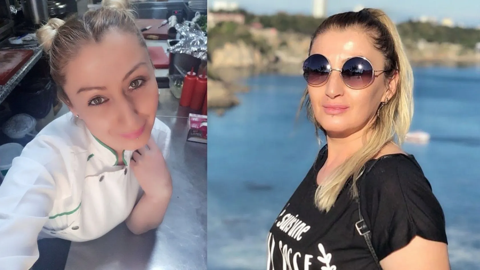 Estetik işlem sonrası dudağı çürüdü, 7 yıldır hukuk mücadelesi veriyor