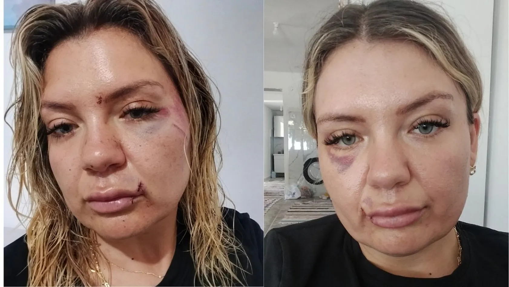 Eski sevgilisinin elinden kırılan bıçakla kurtuldu