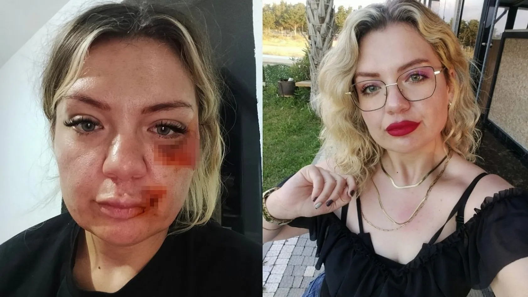 Eski sevgilisinin elinden kırılan bıçakla kurtuldu