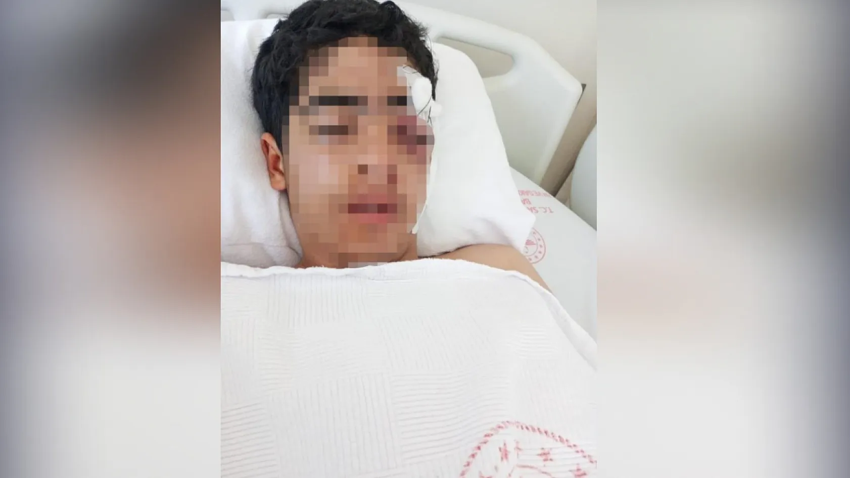 Akran zorbalığına bir yenisi eklendi: 15 yaşındaki çocuk muştayla öldüresiye dövüldü