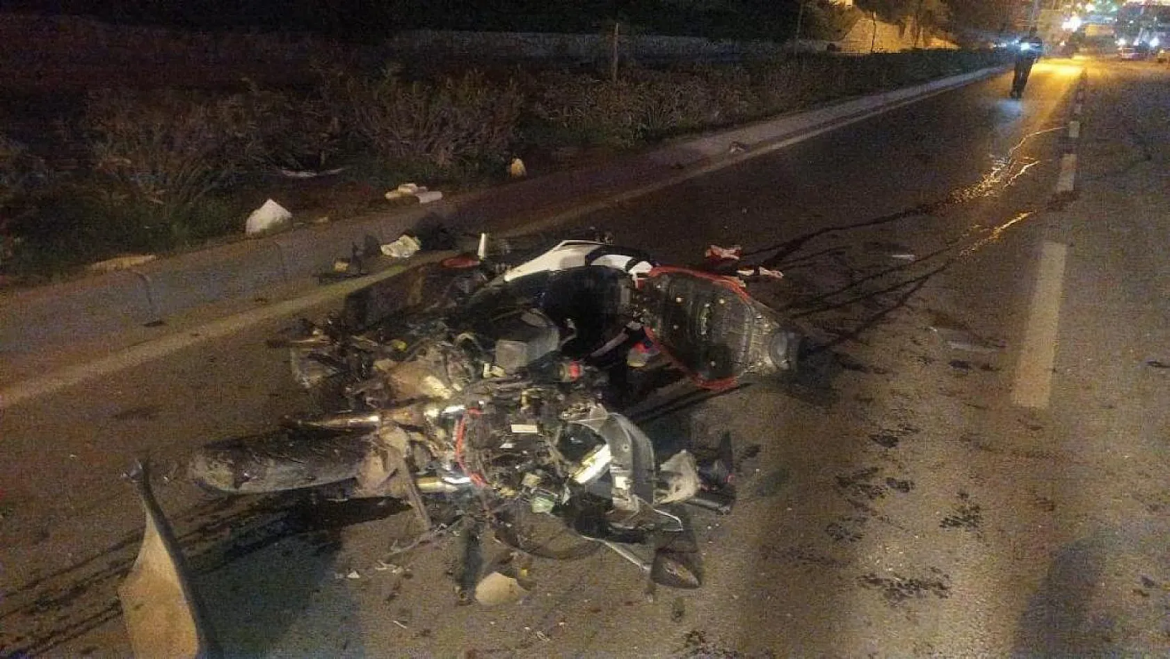 11 aylık yaşam savaşını kaybetti