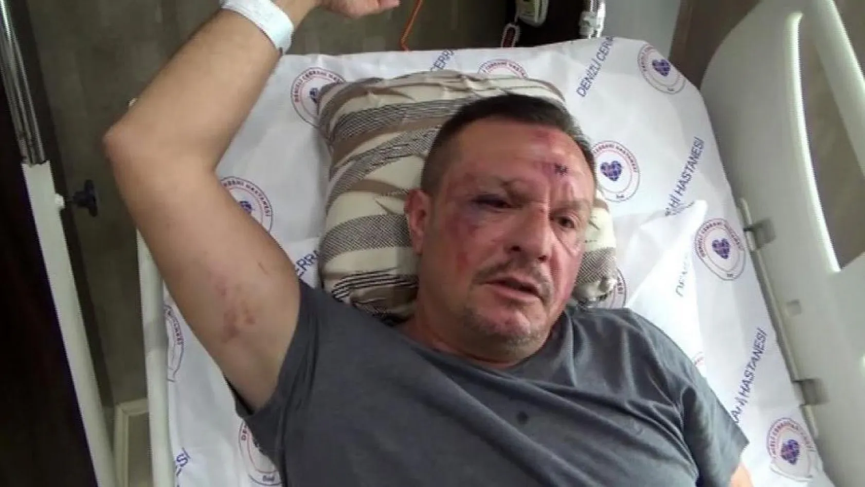 Daha önce Fethiye'de kavgaya karışan Denizlispor'un eski Başkanı Çetin bıçaklandı