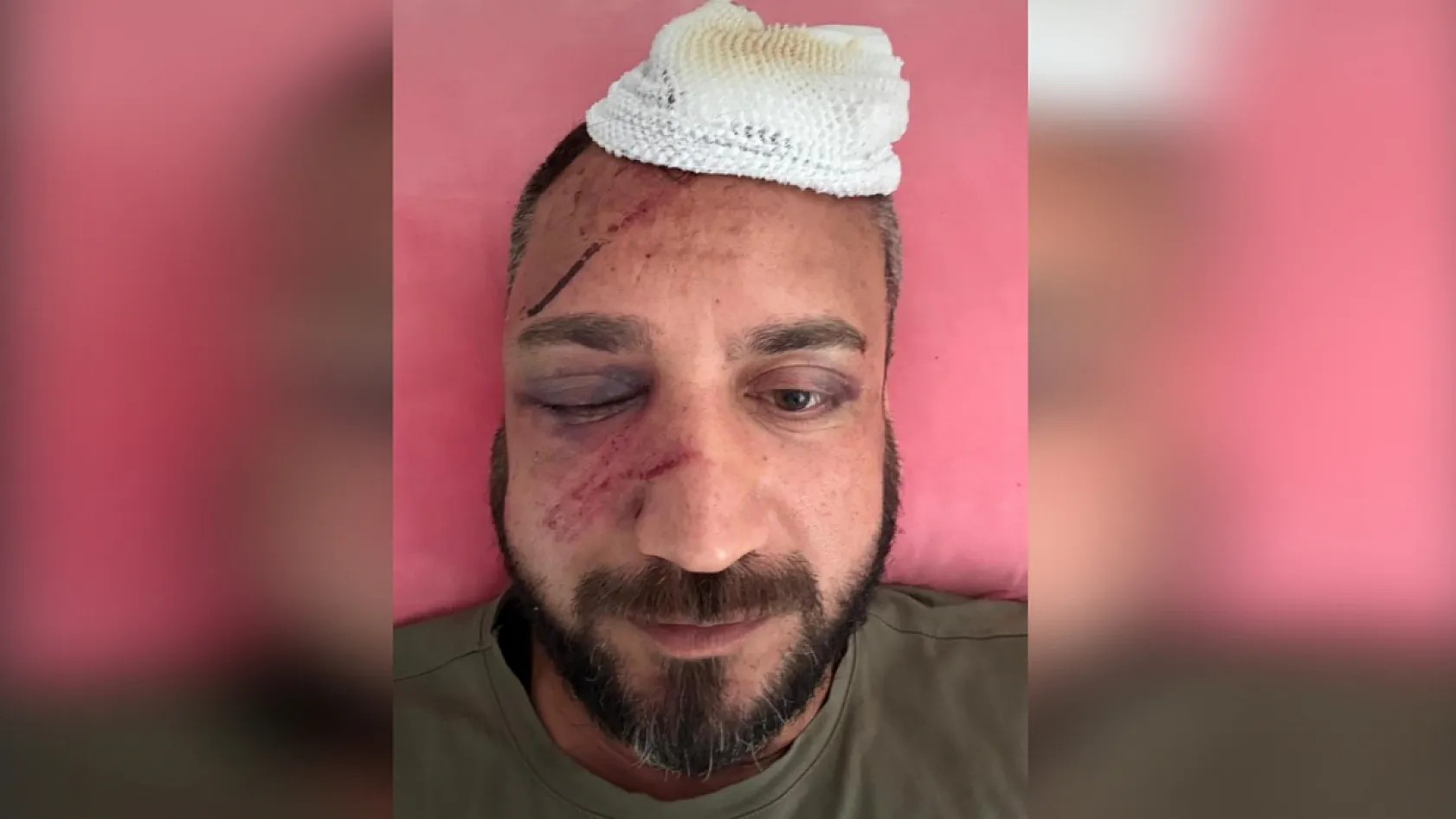 İcra talebi hayatını kararttı! Eski sevgilisinin ailesi hastanelik etti