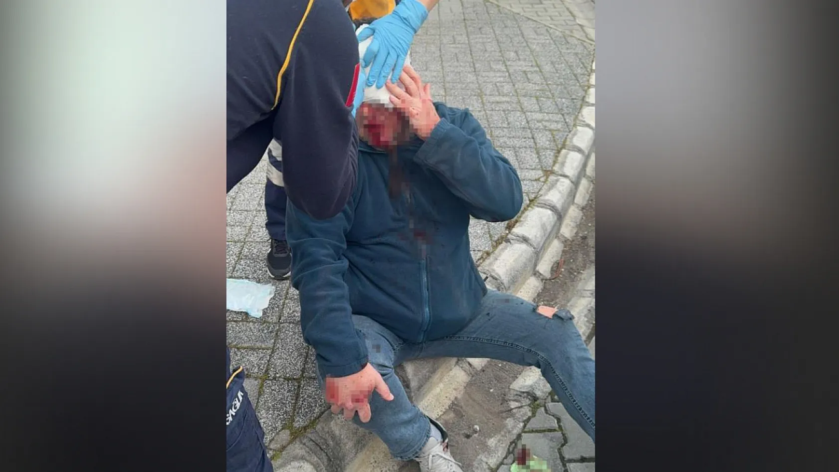 Gazeteci Ersan'a saldırıyla ilgili 5 şüpheli gözaltına alındı