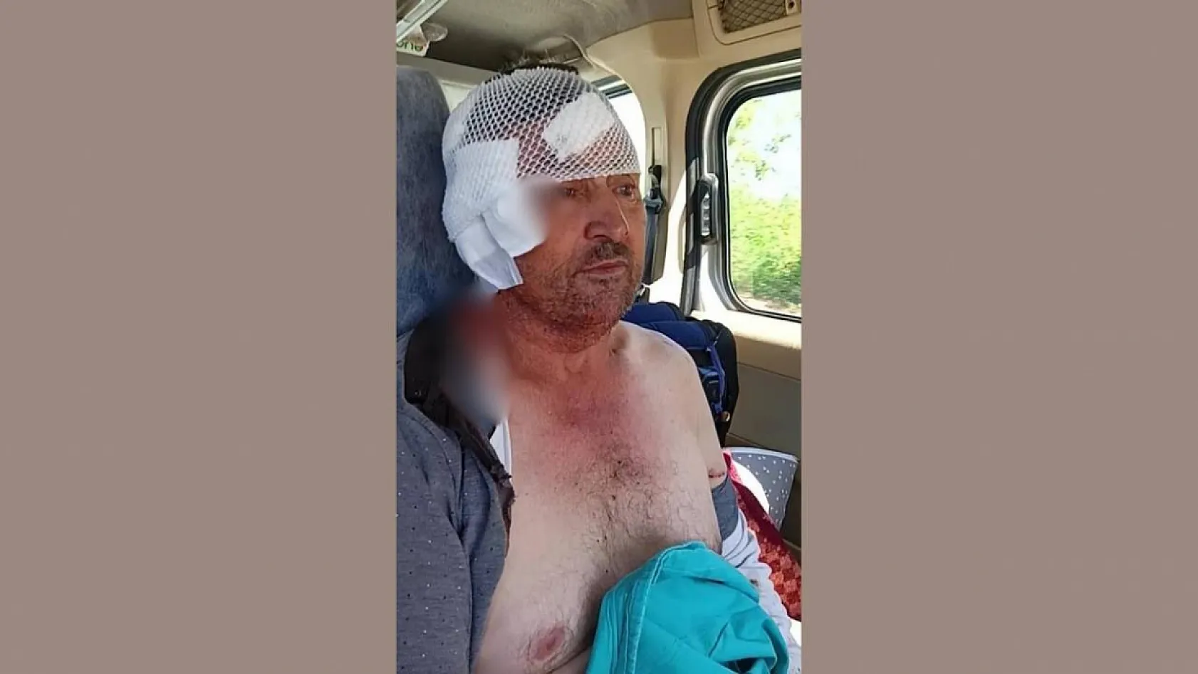 Aslanın saldırısına uğrayan çiftçi o anları anlattı: 'Biraz güçlü olmasaydım, şu anda bende belki de yoktum'