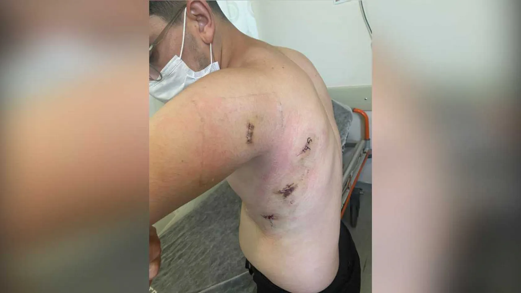 Kız kardeşini korumak isterken 5 yerinden bıçaklanmıştı: O anları anlattı: 'Ölümden döndüm'