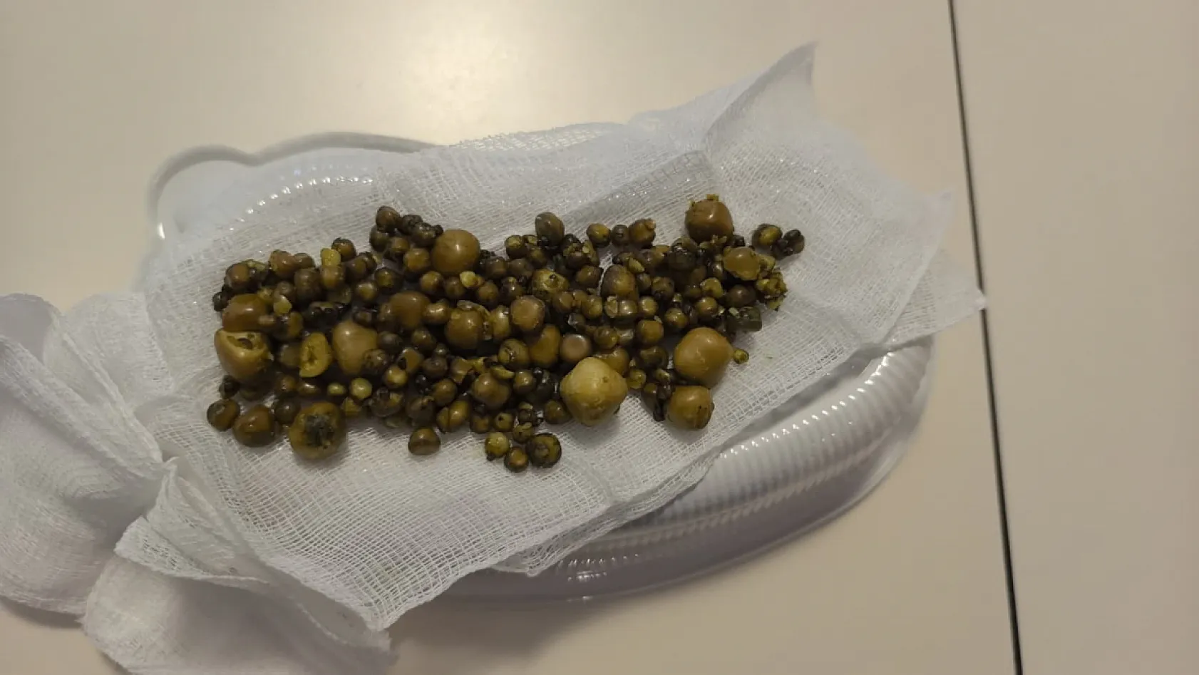 Doktorlar gözlerine inanamadı