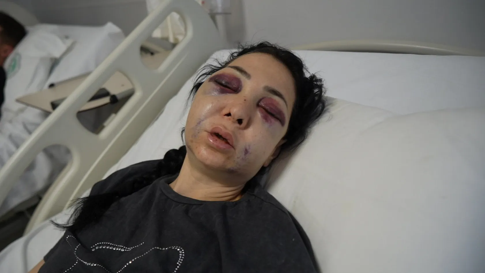 Oğlunun gözü önünde anneyi öldüresiye dövdüler: 'Küfür etmeyin' dedik diye bu hale geldim'
