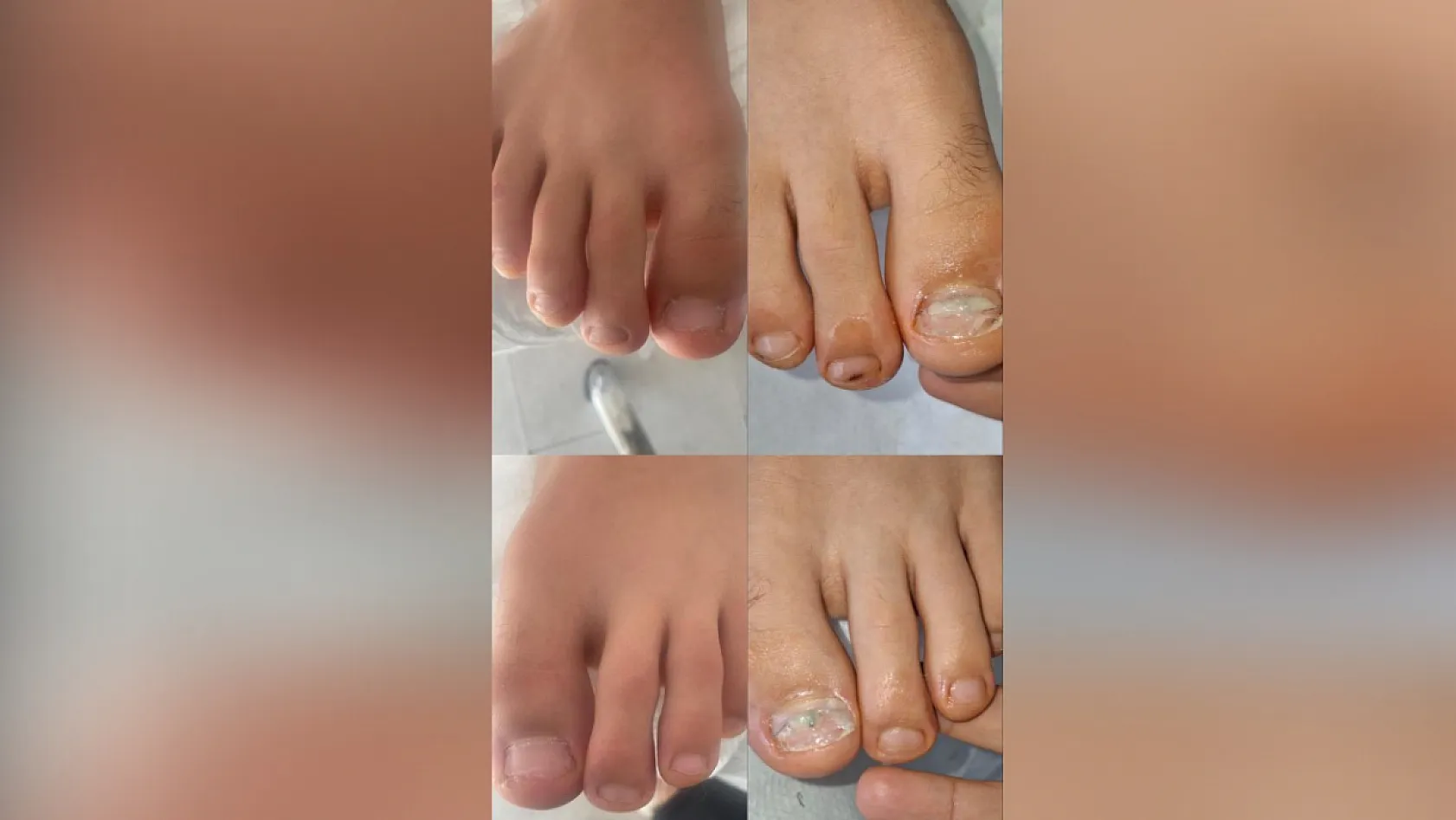 Fethiye'de 'ayak sağlığında' yeni dönem: İlk podoloji merkezi hizmete açıldı