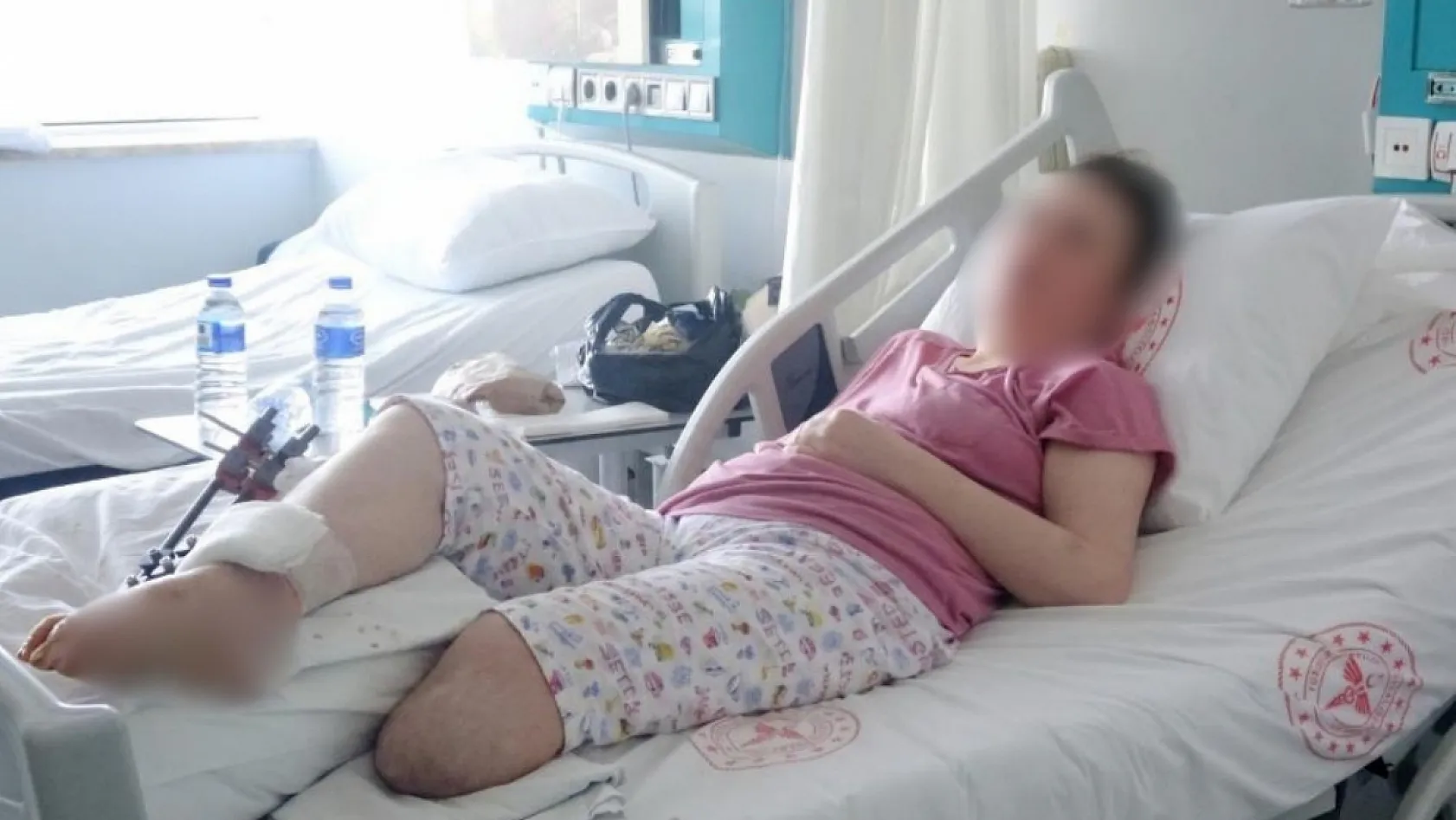 Fethiye'de boşanma aşamasındaki eş dehşeti: Kadın bir bacağını kaybetti