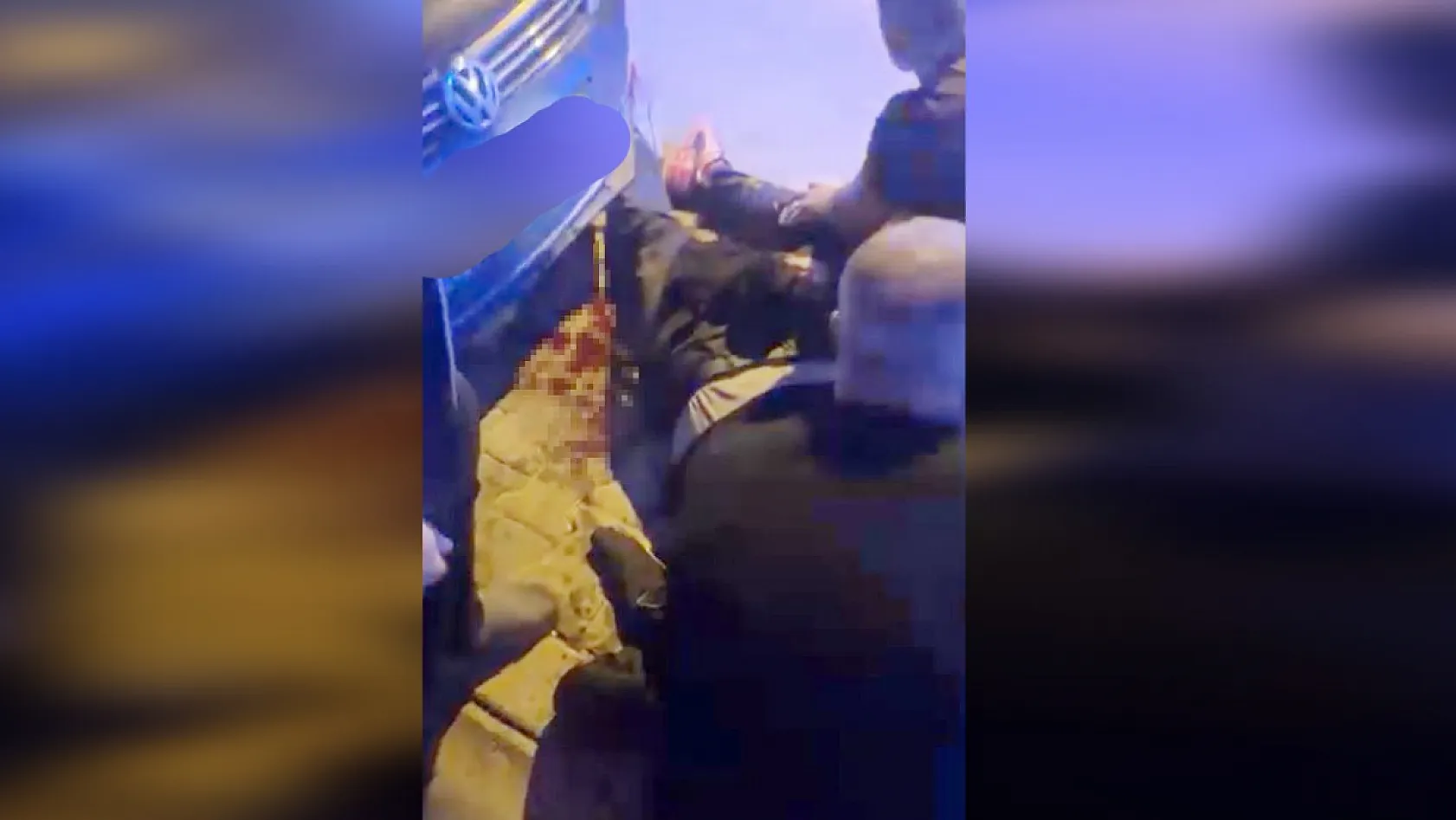 'Kız meselesi' yüzünden bacağından vuruldu, 'Bir kurşun bir şey yapmaz' diye mesaj attı