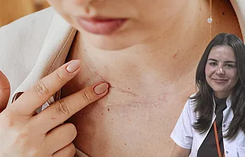 Uzmanlar uyardı: 'Basit leke zannettiğimiz bir lezyon cilt kanseri de olabilir'
