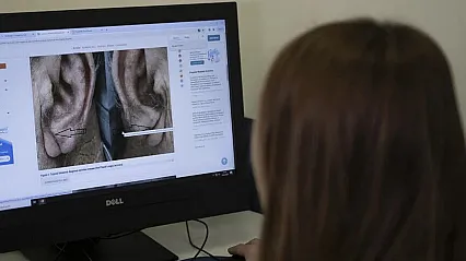 Kulak memesindeki çizgi tek başına kalp krizi habercisi değil