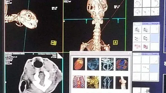 Ege Ve Akdeniz Bölgelerinde İlk Ve Tek